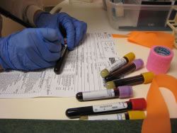 Therapeutic Drug Monitoring